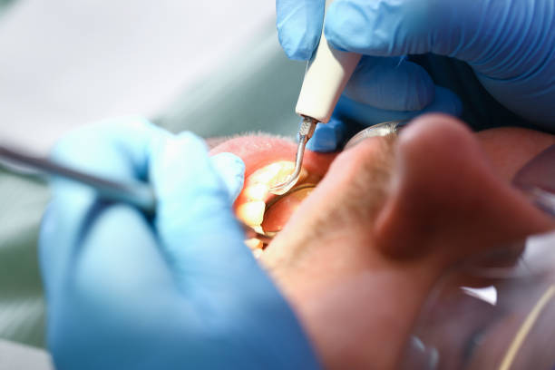 Best Emergency Care for Gum Disease in Hemby Bridge, NC