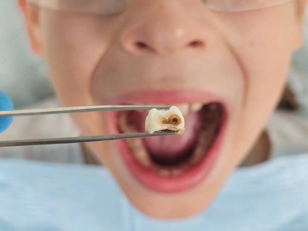 Best Emergency Root Canal Therapy in Hemby Bridge, NC